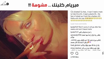 بالصور: شاهدي كيف تمّ تشويه وجه ميريام كلينك