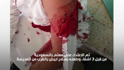 الاعتداء على معلم بالسعودية وطعنه من قبل 3 اشقاء بالقرب من مدرسته