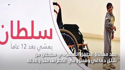 طفل سعودي يستطيع المشي على قدمه لاول مرة في حياته بعد 12 عام بمساعدة اطباء بمستشفي الملك فيصل