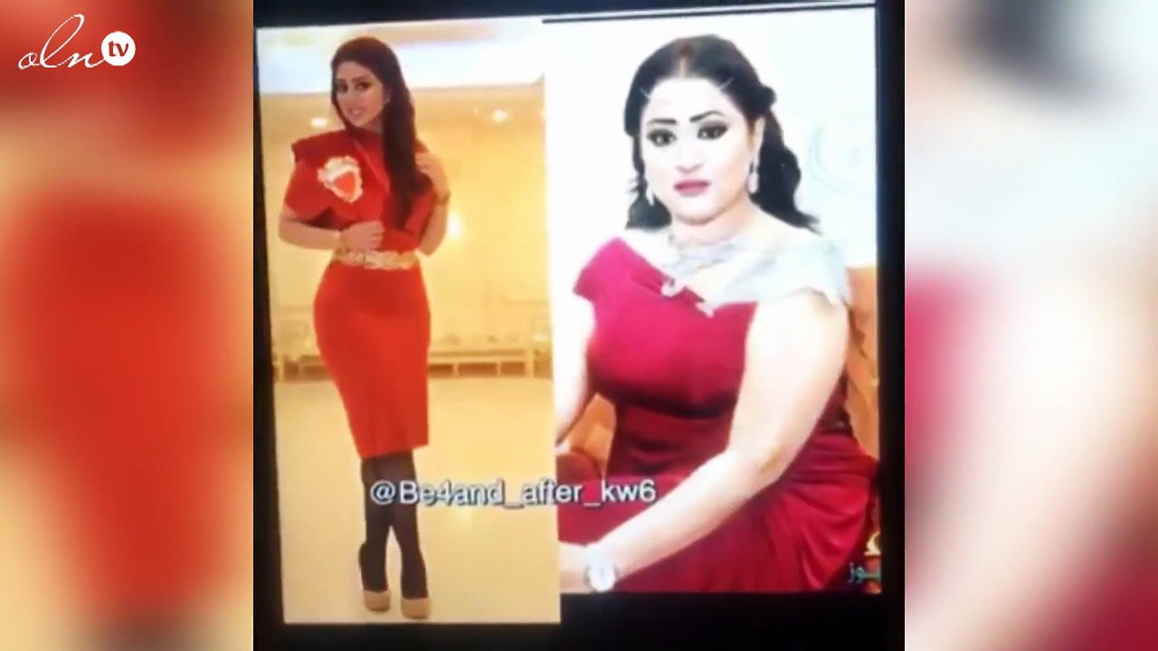 صورة شيماء سبت قبل عمليات التجميل تشعل مواقع التواصل الاجتماعي.. وهذا كان ردّها..بالفيديو!
