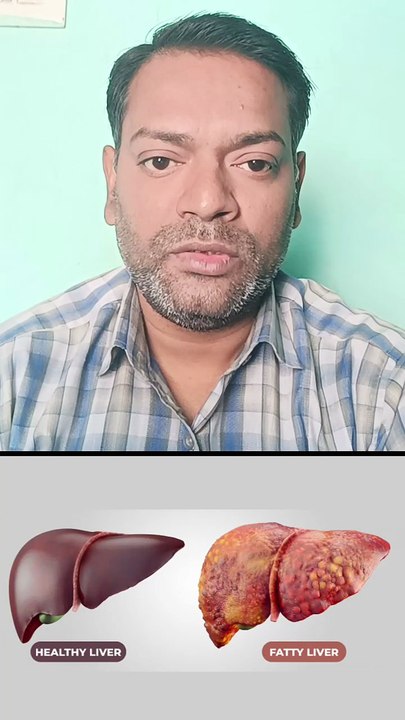 फैटी लीवर में लीवर खराब ।