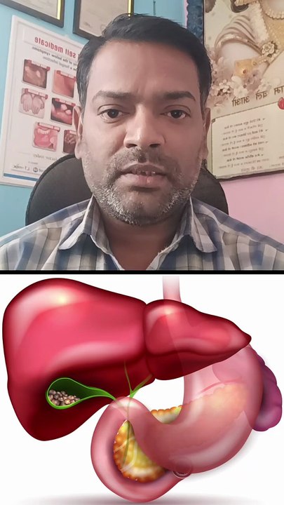 क्या पथरी से पित्ताशय फट सकता है ।