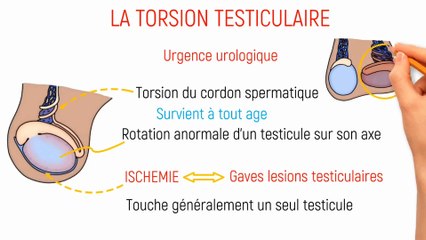 LA TORSION TESTICULAIRE: Causes, symptômes, Diagnostic et traitement