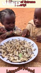 The reality of child malnutrition | severe malnutrition in Uganda #uganda #hungercrisis #foodshortage #food
