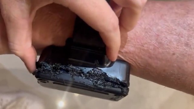 Corte Suprema revela que Jair Bolsonaro intentó quemar su tobillera electrónica con un soldador