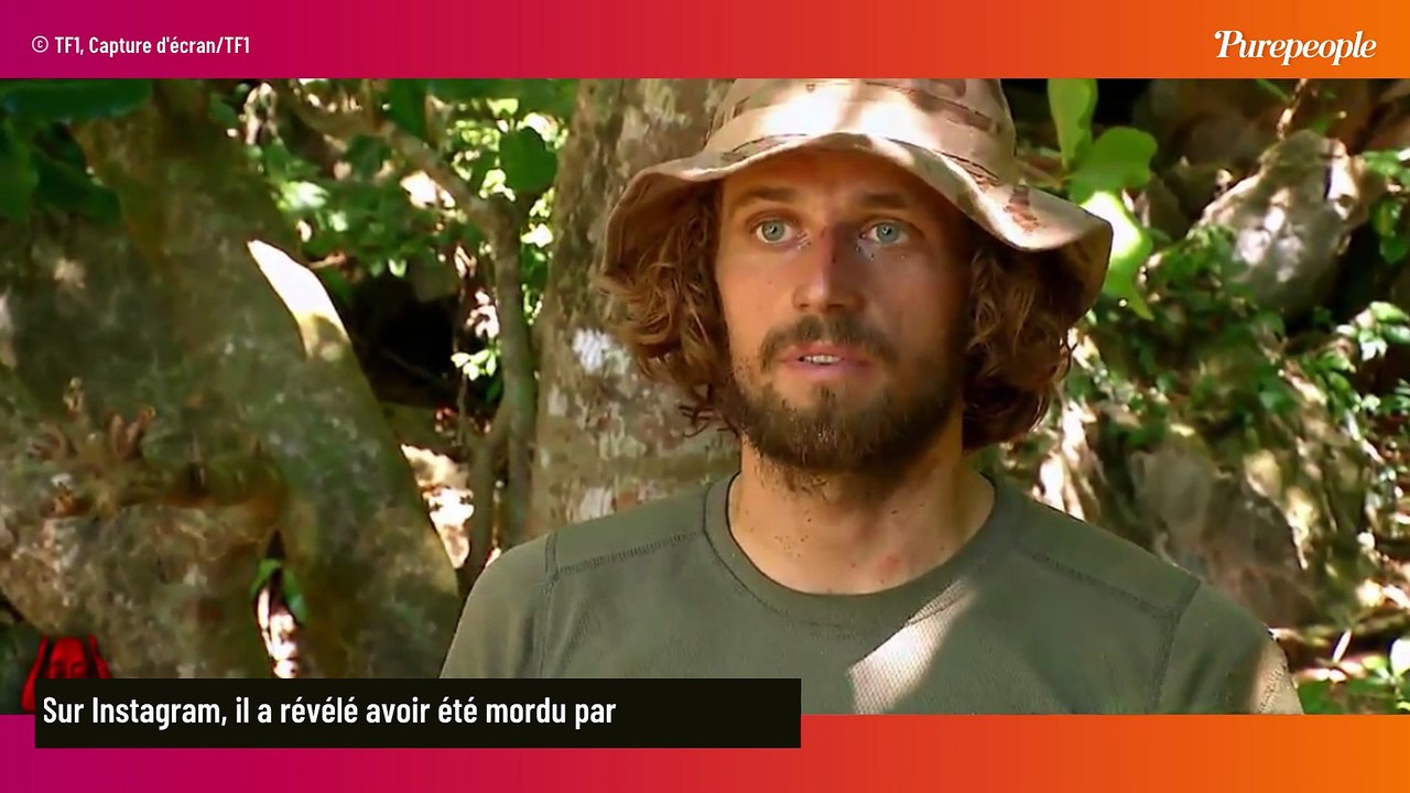 "Ca m'a mis complètement K.O" : Gustin de Koh Lanta a perdu 7 kilos après avoir été touché par un insecte