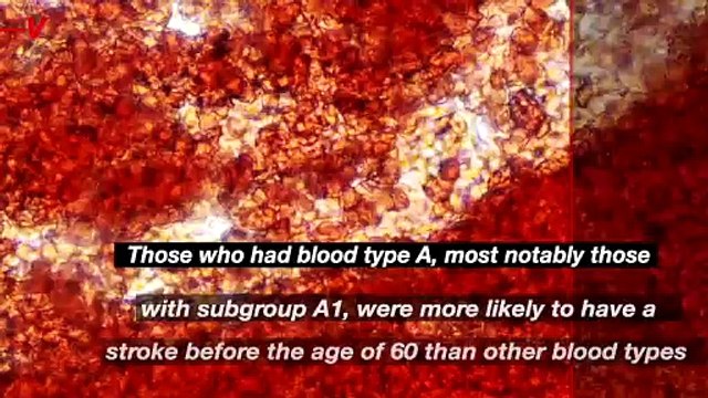 Study Links One Blood Type to Increased Stroke Risk Before 60.mp4