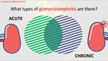 What types of glomerulonephritis are there?