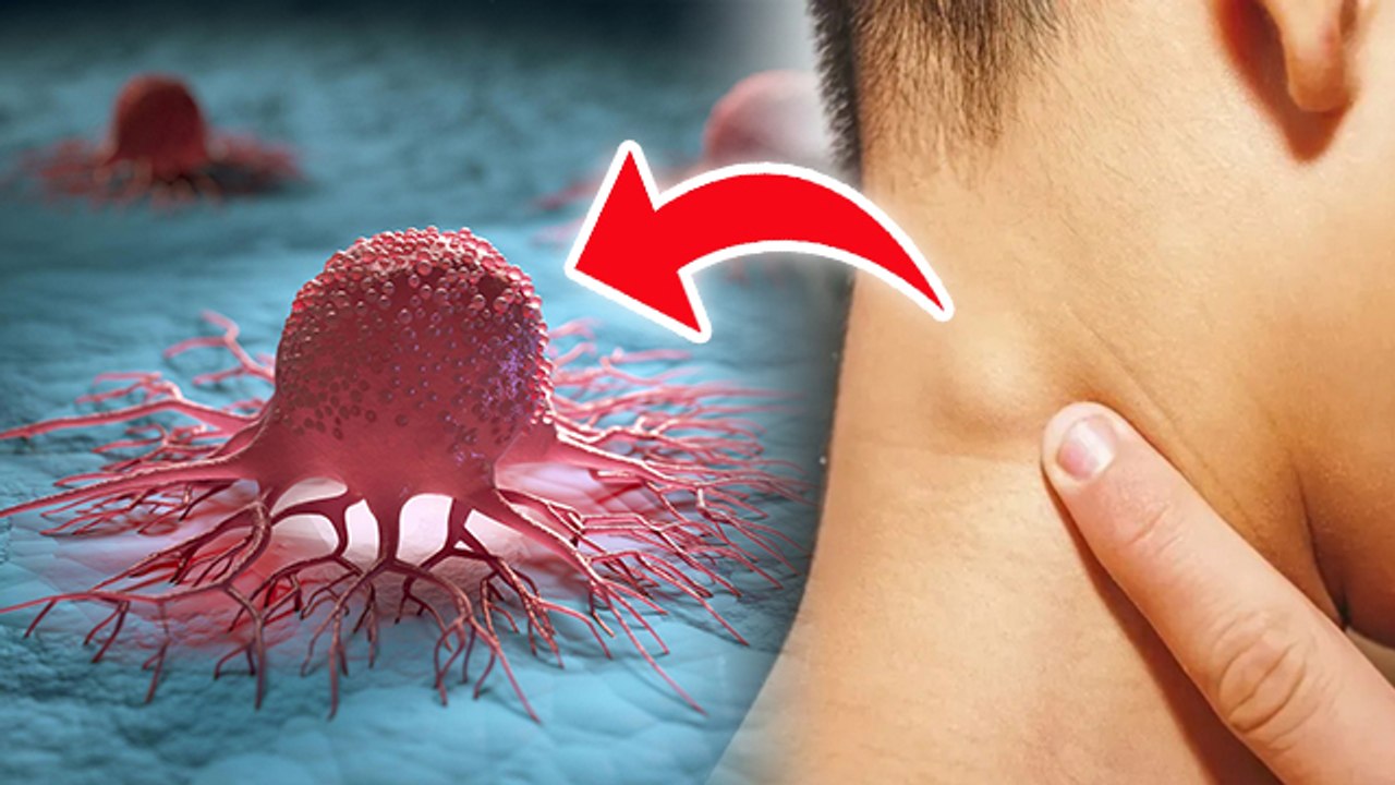 Cancer Ki Ganth kaise Pahchane : कैंसर की गांठ कैसे होती है,पहचान कैसे ...