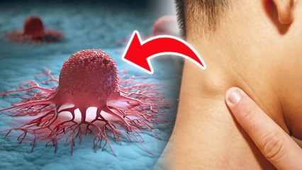 Cancer Ki Ganth kaise Pahchane : कैंसर की गांठ कैसे होती है,पहचान कैसे करें  | Cancer Tumor Symptoms