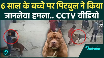 Pitbull Dog Attack : Delhi में पिटबुल ने 6 साल के बच्चे पर हमला किया, काट खाया कान |वनइंडिया हिंदी