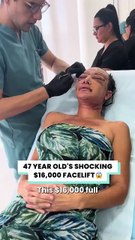 Her new face looks 30 years younger 🤩