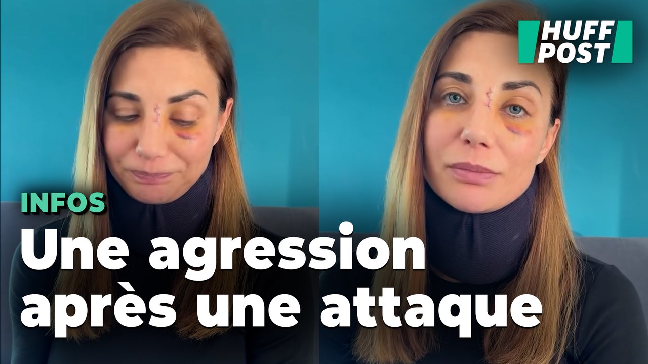 Ariane Brodier s’exprime après avoir subi une grave agression, trois jours après qu’un chien l’a attaquée