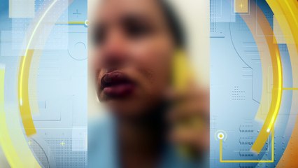 Desmascarando Violência Doméstica: Relato de Mulher que Sobreviveu a Agressões após Separação em Recife