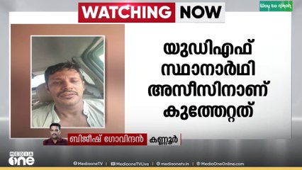 കണ്ണൂരിൽ UDF സ്ഥാനാർഥിക്ക് കടന്നൽ കുത്തേറ്റു