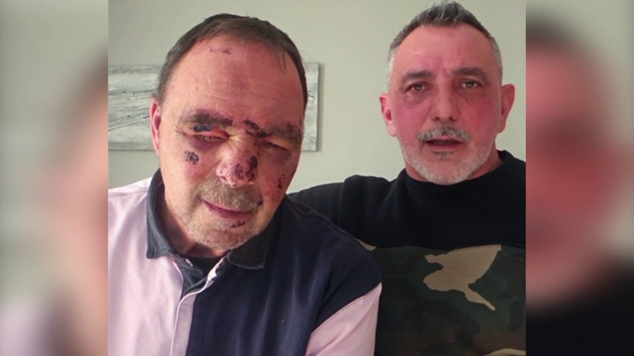 «Ils se sont acharnés sur lui avec des coups de...