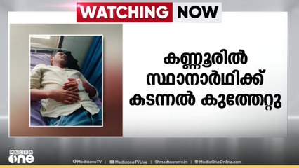 കണ്ണൂരിൽ സ്ഥാനാർഥിക്ക് കടന്നൽ കുത്തേറ്റു...