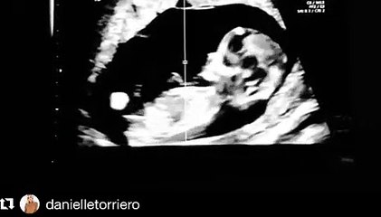 Talan Torriero: 'Laguna Beach' Star Expecting 1st Child -- See Adorable Ultrasound Video