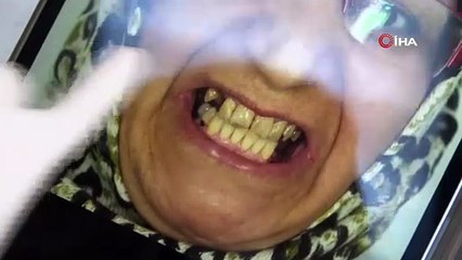 Diş tedavisinde implantı rafa kaldıracak yöntem... Deprem sonrası konutlardan yola çıkıp, başardı!