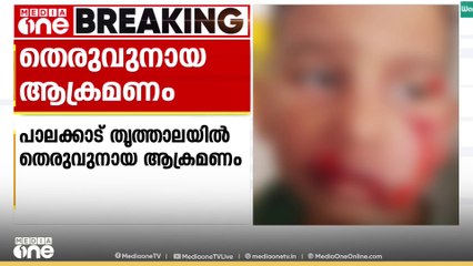 പാലക്കാട് തൃത്താലയിൽ തെരുവുനായ ആക്രമണത്തിൽ 4 വയസ്സുകാരന് ഗുരുതര പരിക്ക്