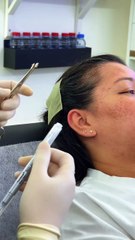 Showcasing My Vertical Helix #vertical #helixpiercing #earpiercing #nosepiercing #cartilagepiercing