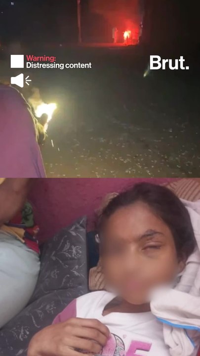 Sam Pepper's Diwali celebrations injured a young girl