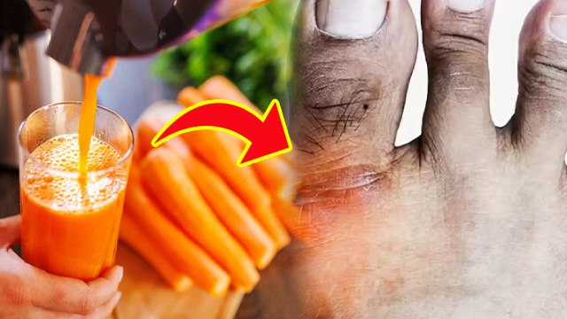 Uric Acid : High Uric Acid Me Gajar Khana Chahiye, क्या गाजर खाने से यूरिक एसिड बढ़ता है…..l Boldsky