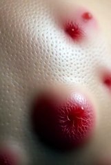 10. Allergic Skin Reaction