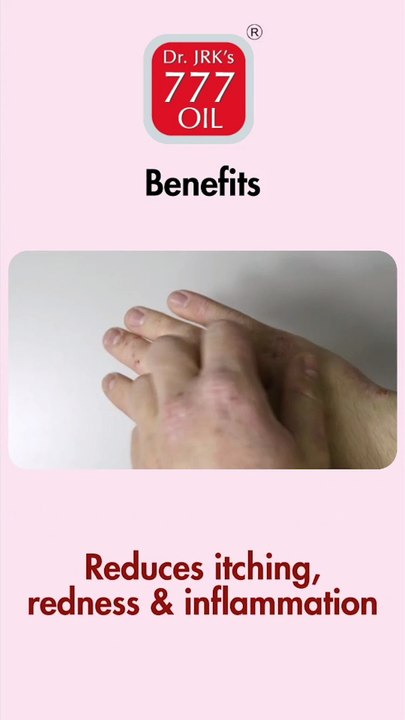 Best oil for Psoriasis