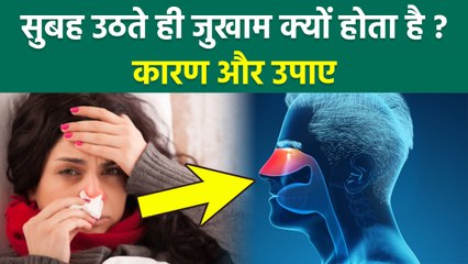 Morning Cold And Sneezing : Subha Uthte Hi Naak Band Kyun Ho Jati Hai? लक्षण और इलाज...... | Boldsky
