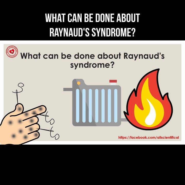 What can be done about Raynaud's syndrome?