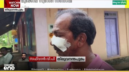 മോഷണശ്രമം തടഞ്ഞ വയോധികന്റെ മുഖത്തിന് വെട്ടേറ്റു