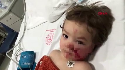 Pitbull saldırısında iki çocuk yaralandı