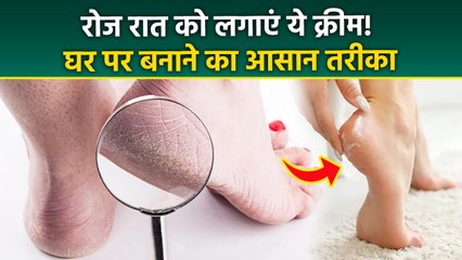 Foot Cream For Cracked Heels : घर पर फुट क्रीम कैसे बनाएं? Cracked Feet Home Remedy....... | Boldsky