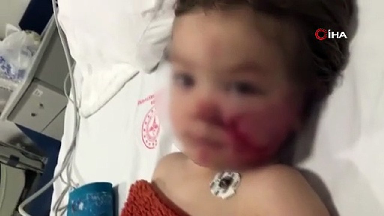 Ankara’da çocuklarına pitbull saldıran acılı baba isyan etti: "Bu kız hakkında 12 tane şikayet var ve hiçbir şey yapılmamış"