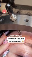 This accident left her in a spinal halo brace 😱