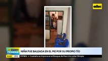 Niña fue baleada en el pie por su propio tío