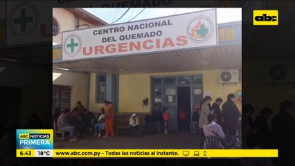 Joven sufrió quemaduras en todo el cuerpo luego de que se le derramó resina con ácido