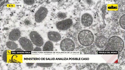 Salud analiza primer caso sospechoso de viruela del mono en Paraguay
