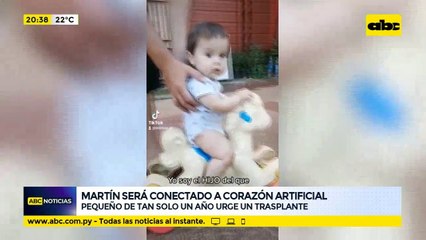 Martín será conectado a corazón artificial