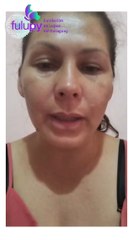 Rumilda Enciso Madre De Una Niña Con Lupus Clama Medicamentos Al Presidente De La República Santiago Peña