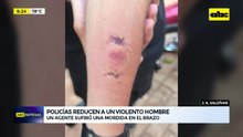 Mordió a un policía para no ser detenido: hombre tenía arresto domiciliario