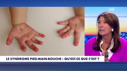La chronique santé : Le syndrome pied-main-bouche, qu'est-ce que c'est ?