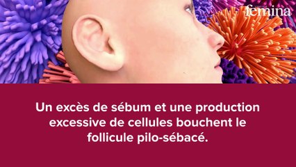 Des boutons sur le front cet hiver ? Vous tenez peut-être le coupable entre vos mains