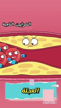 ما هي دعامات الأوعية الدموية؟ _explorepage _foryoupage _boostyourreels _trendingreels(MP4)
