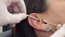 The Daith Piercing: Procedure, Healing, & Aftercare Guide #daithpiercing #earpiercing #helixpiercing