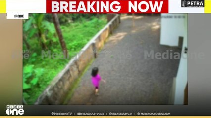 മലപ്പുറത്ത് തെരുവ് നായ ആക്രമണത്തിൽ നിന്ന് നാല് വയസുകാരി രക്ഷപ്പെട്ടത് തലനാരിഴയ്ക്ക്