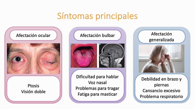 Miastenia Gravis #elcuerpoymas #salud #medicina #Miasteniagravis #Miastenia