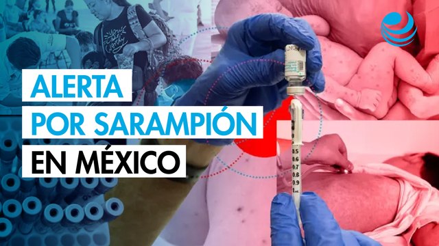 Sarampión en México: Salud reporta más de 8,000 casos y 27 defunciones a un año del primer brote