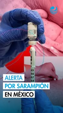 Sarampión en México: Salud reporta más de 8,000 casos y 27 defunciones a un año del primer brote